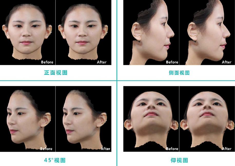 中科院科学家告诉你，3D数字整形系统到底靠不靠谱